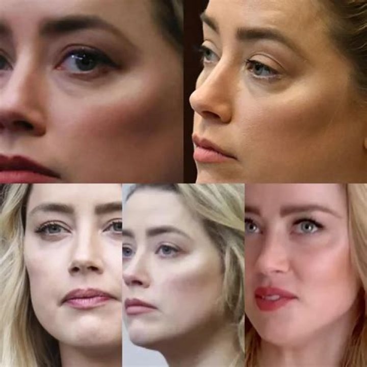 Amber Heard Plastic Surgery Analysis: Before and After Plastic Surgery Look - SarkariResult