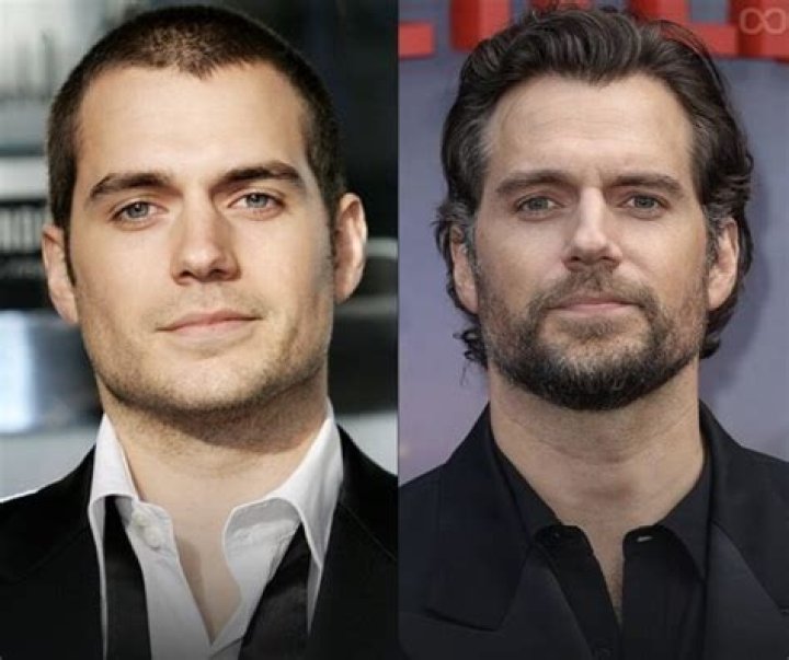 Has Henry Cavill Had Plastic Surgery? Henry Cavill Before and After Photos, Who is Henry Cavill? - SarkariResult